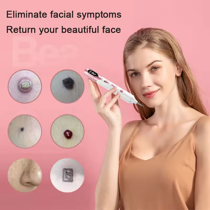 DermaLuz™ Lápiz Laser de Plasma